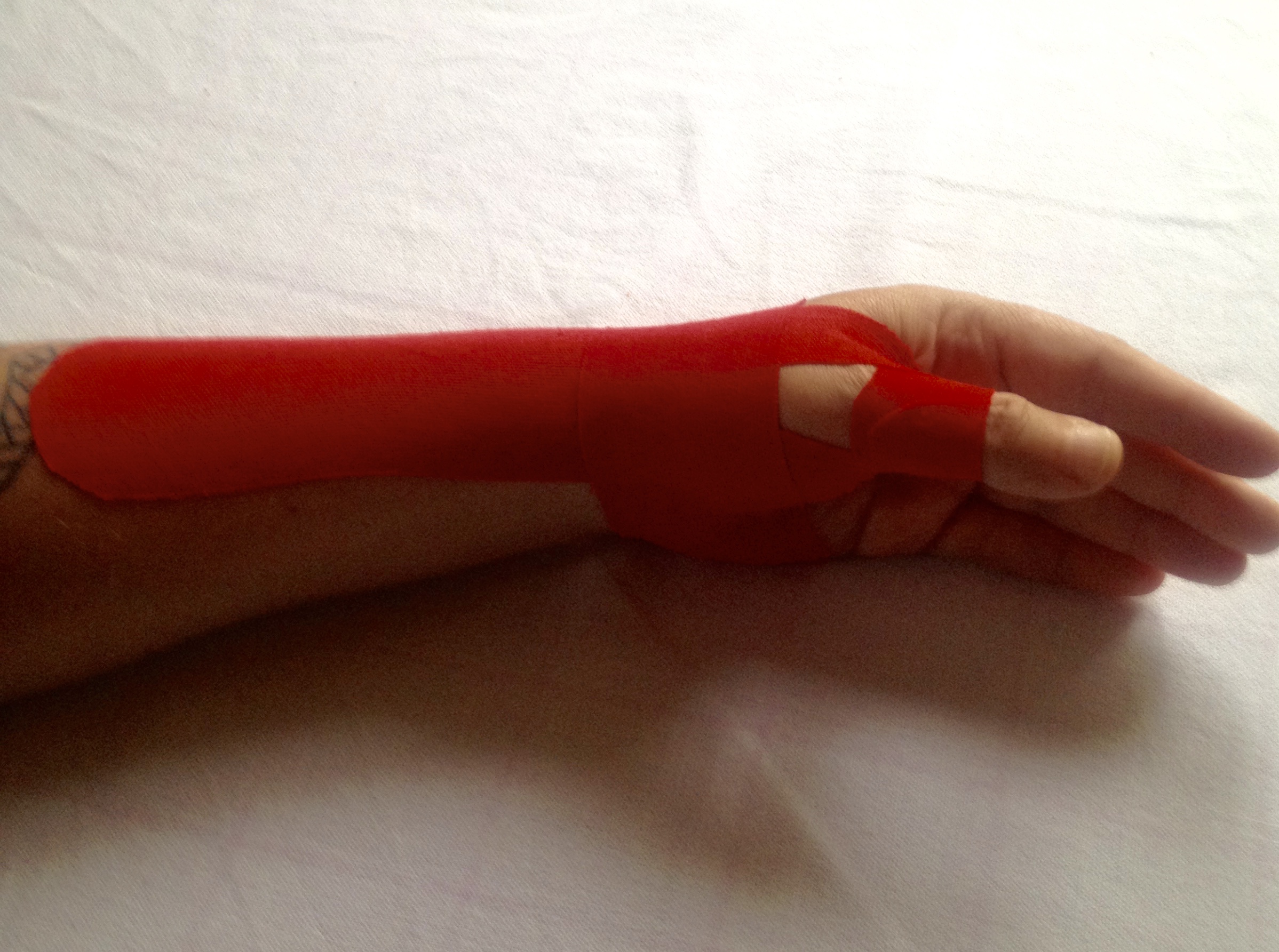 Schmerzen am Daumensattelgelenk